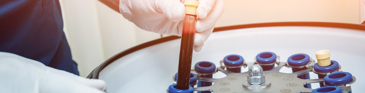 A person holding a tube of blood in their hand.